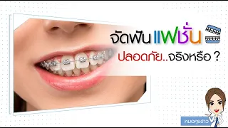 อันตรายจากการจัดฟันแฟชั่นที่ไม่มีทันตแพทย์ดูแล มีอะไรบ้าง