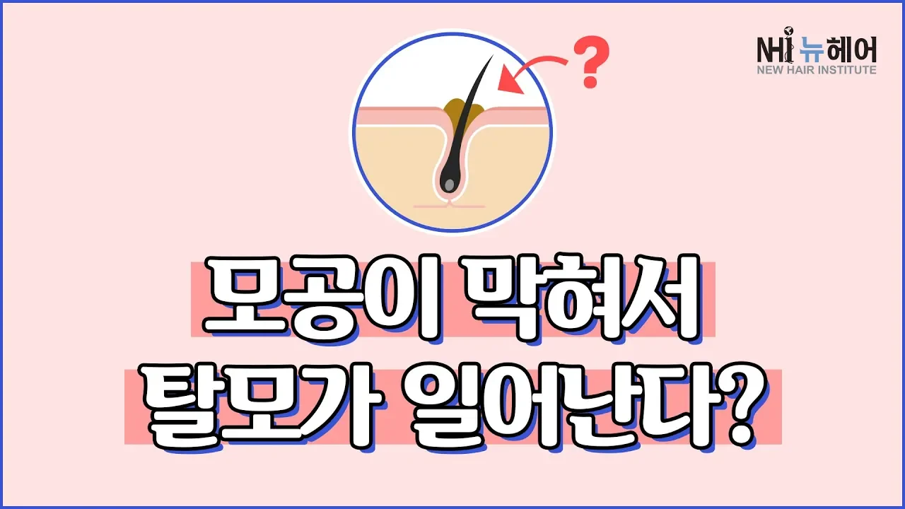 모공이 막혀서 탈모가 일어난다?- 뉴헤어 I 모발이식 I 탈모QnA I