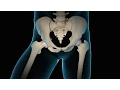 Minimally Invasive Total Hip Replacement THR Nucleus Health