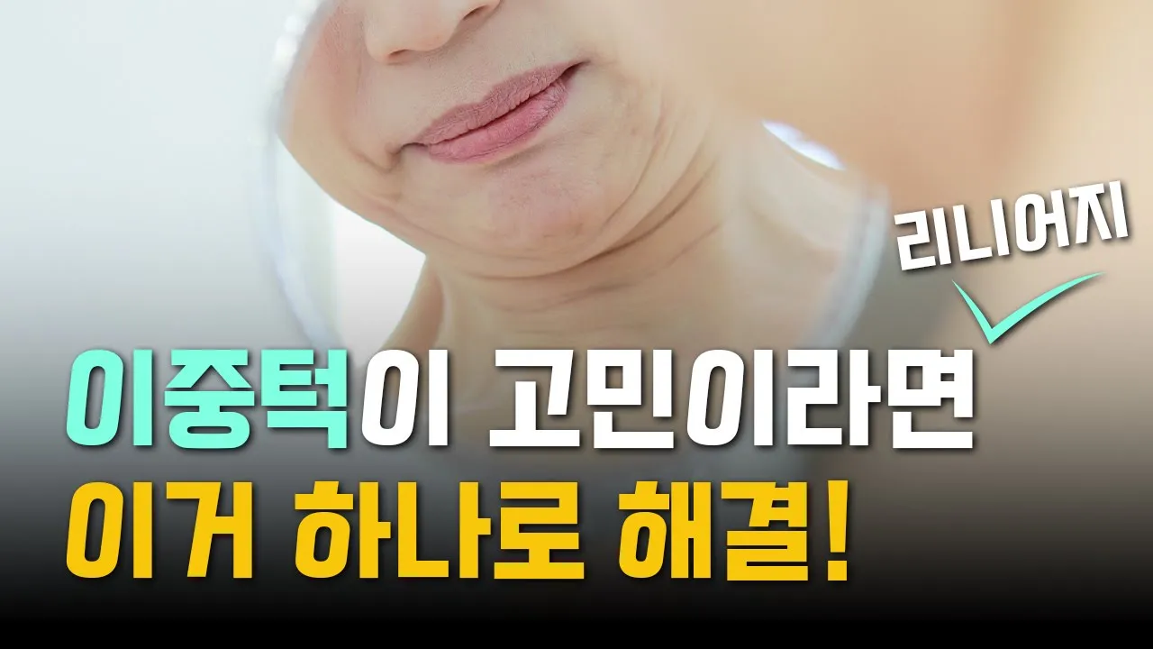 이중턱이 심해서 고민이에요..😥│리니어지효과