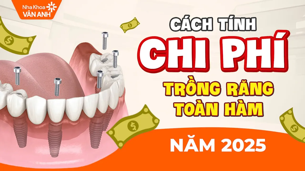 Outline Video Bảng Giá Trồng Răng Toàn Hàm 2025 | Nha Khoa Vân Anh
