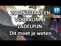 Download Lagu ZO ONTSTAAT EN VOORKOM JE ZADELPIJN: Dit moet je weten