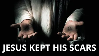 JESUS KEPT HIS SCARS Your Scars Are Proof That God Heals