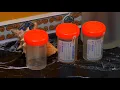 How to Collect Sputum Samples
