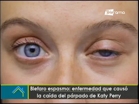 A Katy Perry se le cae el párpado en pleno concierto