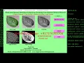 Plant Leaf Disease Detection Using Image Processing Python Code Leaf Disease Classification