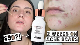 I TESTED 90 Dr Brandt Dark Spots No More ON MY ACNE SCARS FOR 2 WEEKS