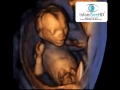 16 WEEK LIVE 4D ULTRASOUND