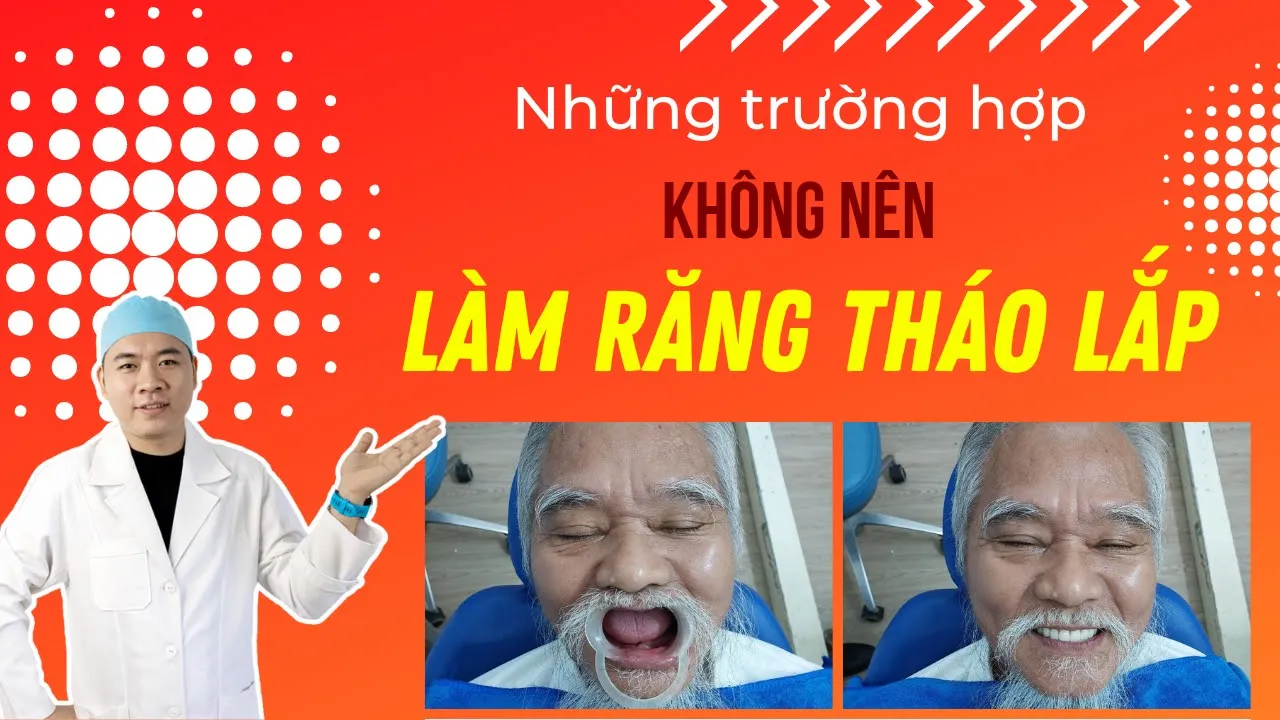 Outline Video Răng tháo lắp| Những trường hợp không nên làm răng tháo lắp I Nha Khoa Smile HT