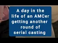 A day in the life of Arthrogryposis serial casting
