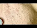 Download Lagu Satisfying video with Chung Vo Spa | 402