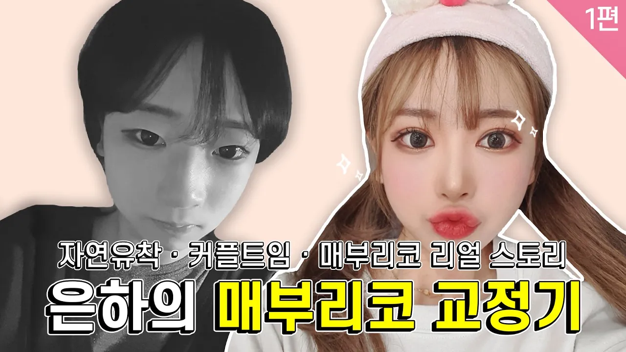자연유착/비절개눈매교정/매부리코성형/휜코교정 : 수술 전 리얼모델 인터뷰!
