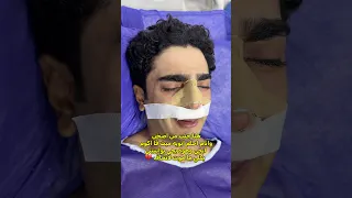 شحجيت بلبنج💔