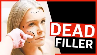 Fillers and BBLs Using Fat From the Dead
