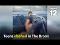 Two teens attacked with a scalpel in The Bronx