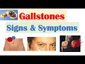Gallstones Signs Symptoms Why They Occur Cholecystitis Choledocholithiasis Cholangitis