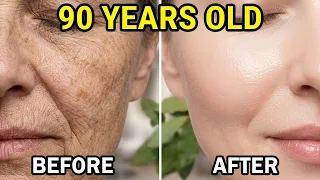 وداعاً للبوتوكس! اكتشفي فوائد كريم الارز المذهلة للتخلص من التجاعيد اقوى كولاجين لشد الوجه كانه فيلر