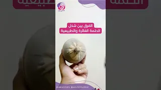 الفرق بين الحلمة الغائرة والطبيعية وهل تسبب مشاكل للرضاعة الطبيعية 