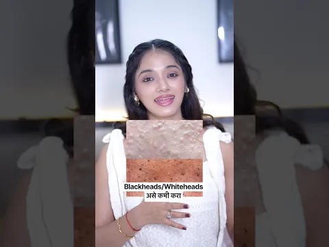 Blackheads कमी करा #ytshorts #skincare #skincareroutine #beauty #explore #shortvideo #fyp