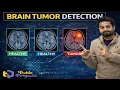 Brain Tumor Detection using Machine Learning Project Image Processing Projects using Python