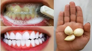 The secret that dentists don't want you to know: Removes tartar and whitens teeth in 1 minute.