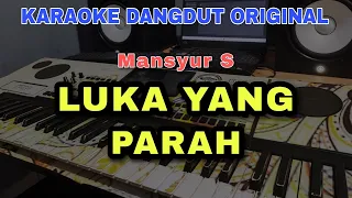 Download LUKA YANG PARAH - MANSYUR S | KARAOKE DANGDUT ORIGINAL VERSI ORGEN TUNGGAL MP3