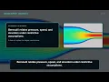 Week 02 Responding to a Mass Imbalance 2145421 Introduction to CFD