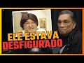 Download Lagu A MORTE do ZACARIAS dos TRAPALHÕES | DEDÉ SANTANA  #podcast #ostrapalhões  #bastidores