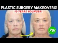 4 Women Get Life-Changing Plastic Surgery Makeovers Everything They Had Done