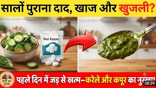 बिना दवाई सालो पुराने दाद खाज खुजली को अब मिलेगा तुरंत जड़ से इलाज पहले दिन मे ठीक Naturalway Remedy