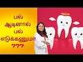Lagu Should I remove shaking Teeth | பல் ஆடினால் பல் எடுக்கணுமா | Dr.Jannani | Mobile tooth Remedies 2021