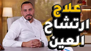 علاج ارتشاح العين   دكتور محمد توفيق عيون دندنها