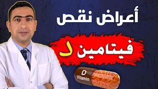 أعراض نقص فيتامين د مصادر فيتامين د الطبيعية تحليل Vit D  أعراض نقص فيتامين د مصادر فيتامين د الطبيعية تحليل Vit D