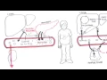 Diabetes Type II Pathophysiology
