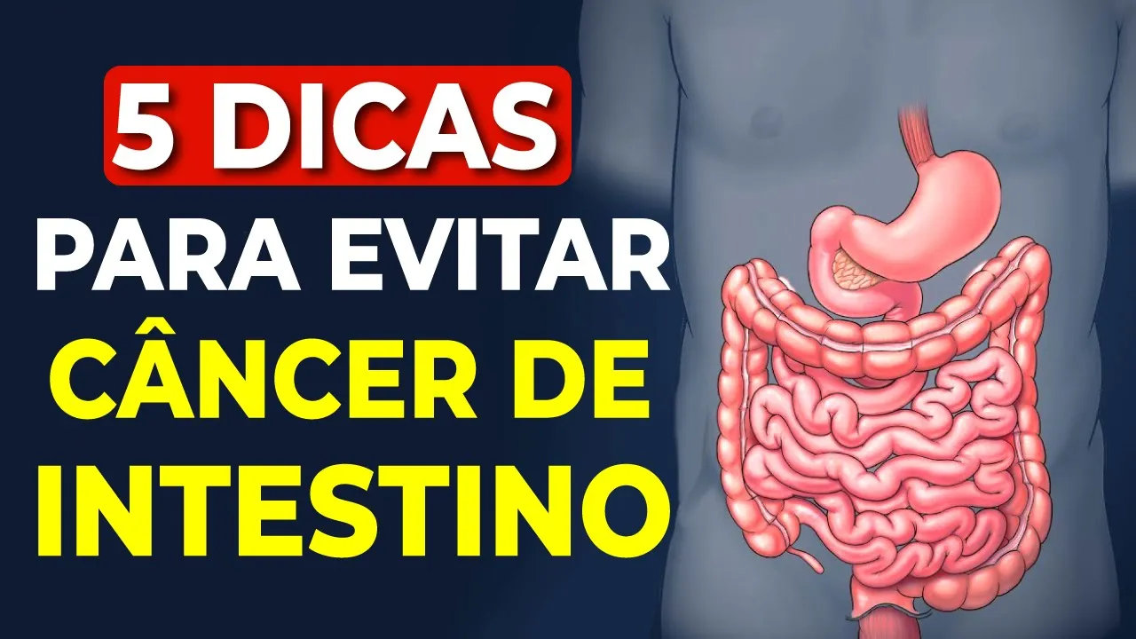 5 Dicas Para Evitar o Cancêr de Cólon (Como Prevenir o Câncer de Intestino)