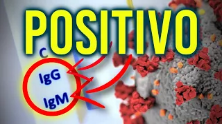 teste covid igm e igg reagente saiba o que significa 