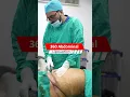 Download Lagu 360 degree Abdomen Liposuction Surgery