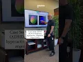 Case Study of AD