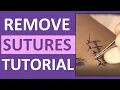 Suture Removal Nursing Skill How to Remove Surgical Sutures Stitches