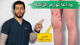 علاج تورم الركبه فى المنزل اسباب تورم والم الركبه وعلاجه تورم الركبه بعد عملية الغضروف 