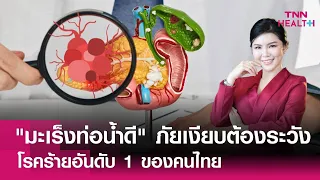  มะเร็งท่อน้ำดีเกิดจากสาเหตุอะไรบ้าง 