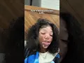 Download Lagu ALL FACTS! 🤣❤️ | #vitiligo #funny #funnyviral #explore #explorepage