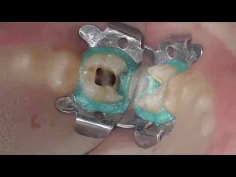 product video thumbnail