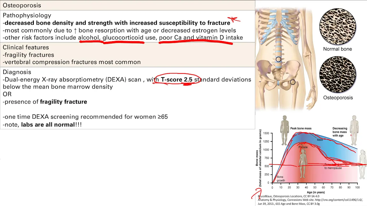 Bone Pathology part 1 | MSK | Step 1 Simplified