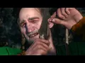 The Witcher 3: Blind Guardian - Blood Of The Elves