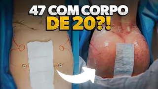 AOS 47 ANOS E COM 5 FILHOS: A TRANSFORMAÇÃO RADICAL DESTA PACIENTE | Casa de Plástico