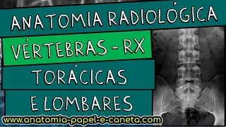 Anatomia radiológica (RX) da coluna vertebral - TORÁCICA E LOMBAR - Sinal do CÃO ESCOCÊS