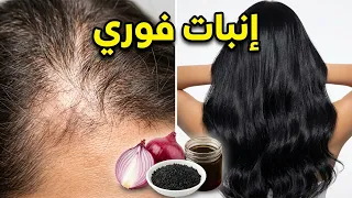مسحة واحدة قبل الاستحمام لعلاج فراغات الشعر والشيب نهائياً وداعاً لتساقط الشعر والصلع!