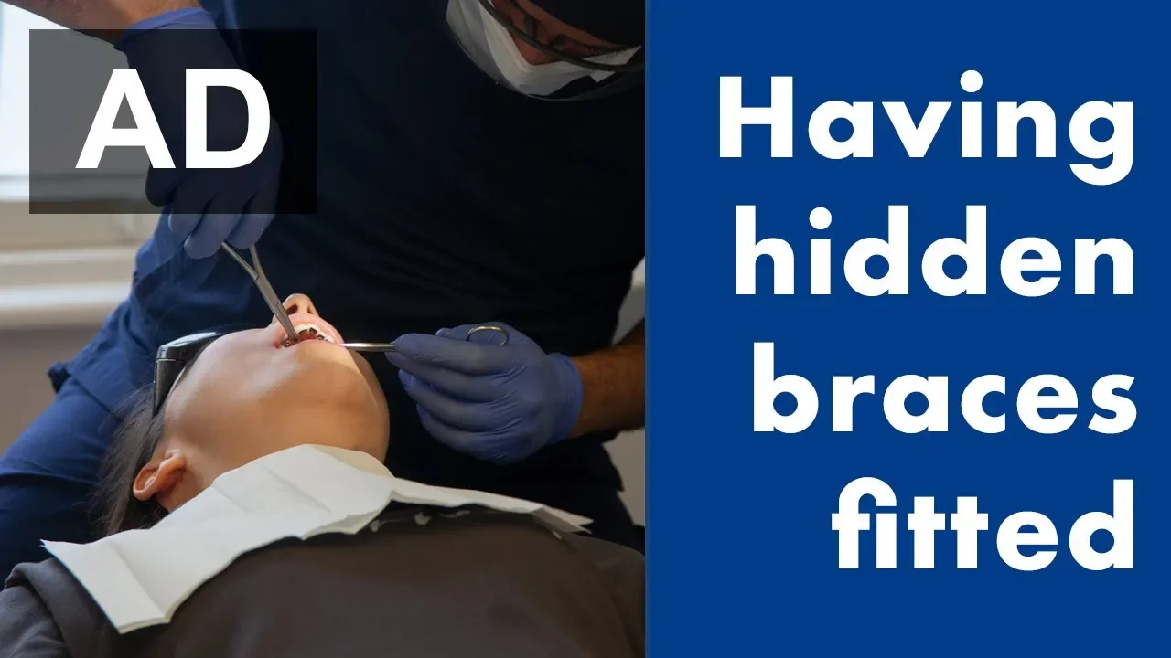 Hidden braces (Incognito) - getting them fitted! #ad