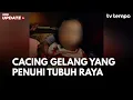 Download Lagu Apakah Cacing Gelang yang Menyebabkan Raya Meninggal?
